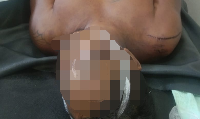 Pria Bertato Terbujur Kaku di Kamar Mayat RSUD Murjani