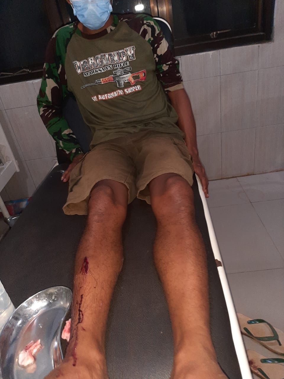 Seorang Sopir Dianiaya Hingga Luka-luka Akibat Pepet Truk Temannya