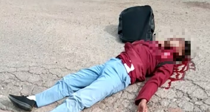 Kecelakaan di Lubang Jalan Trans Kotawaringin Lama, Pelajar Alami Luka Parah