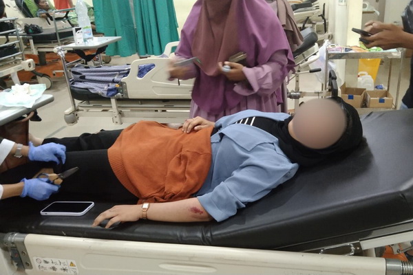 Wanita ini jadi Korban Percobaan Penjambretan