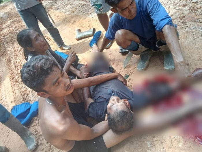 Seorang Pemanen Alami Luka Parah Setelah Dihantam Egrek Saat Duduk Santai