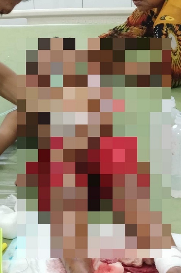 Coba Menyebrang Jalan, Bocah 11 Tahun Ditabrak Mobil