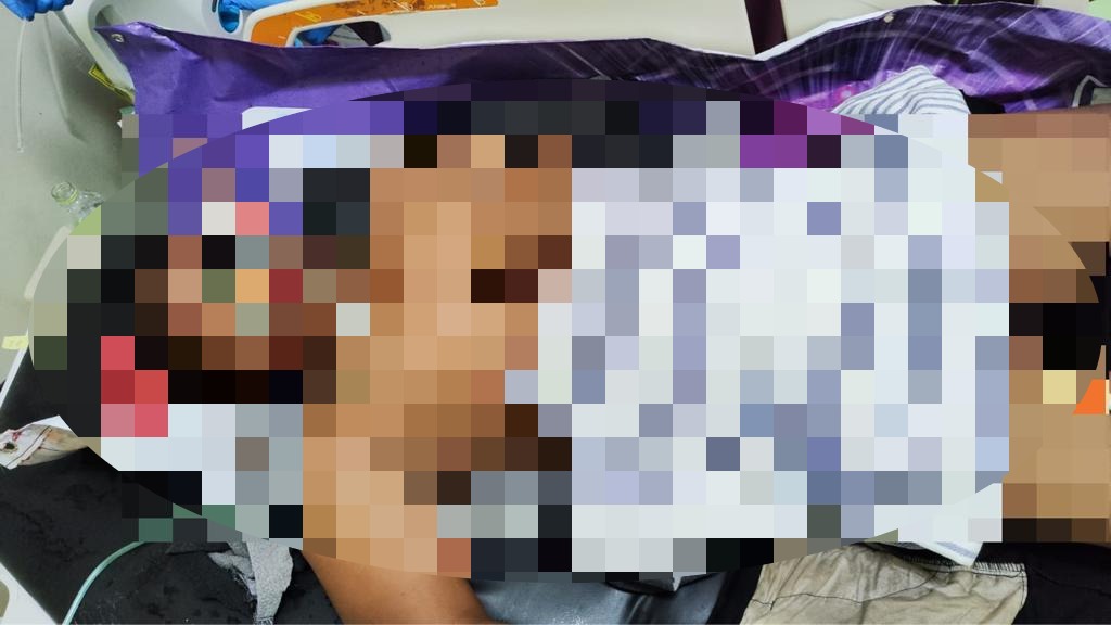 Pria Tanpa Identitas Meninggal Dunia usai Laka Tunggal di Bundaran Samekto