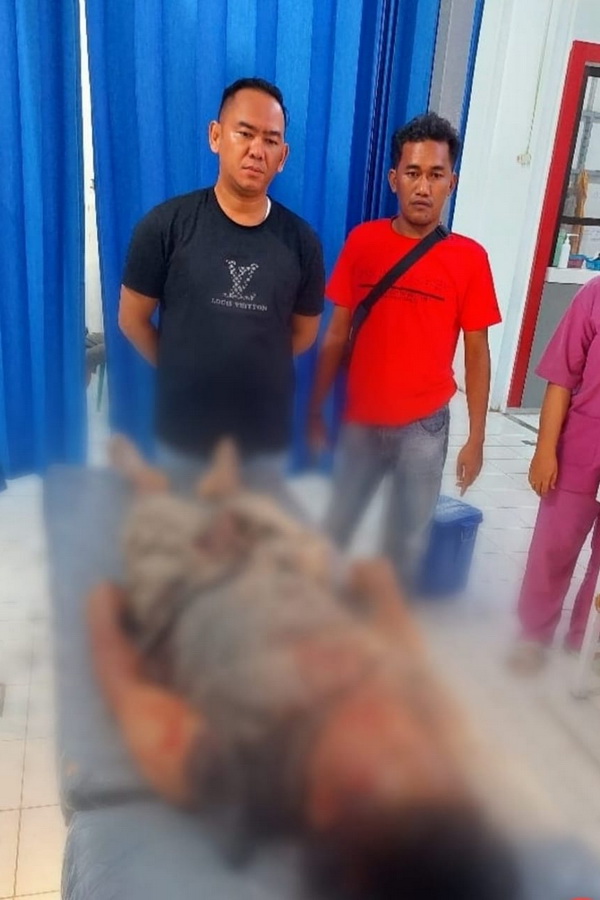 Alami Luka Tusukan, Pemuda di Kapuas Usai Dikeroyok