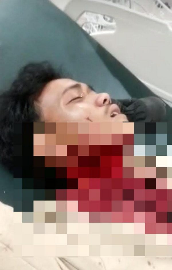 Niat Cari Ponsel yang Tertinggal, AK Jadi Korban Penikaman