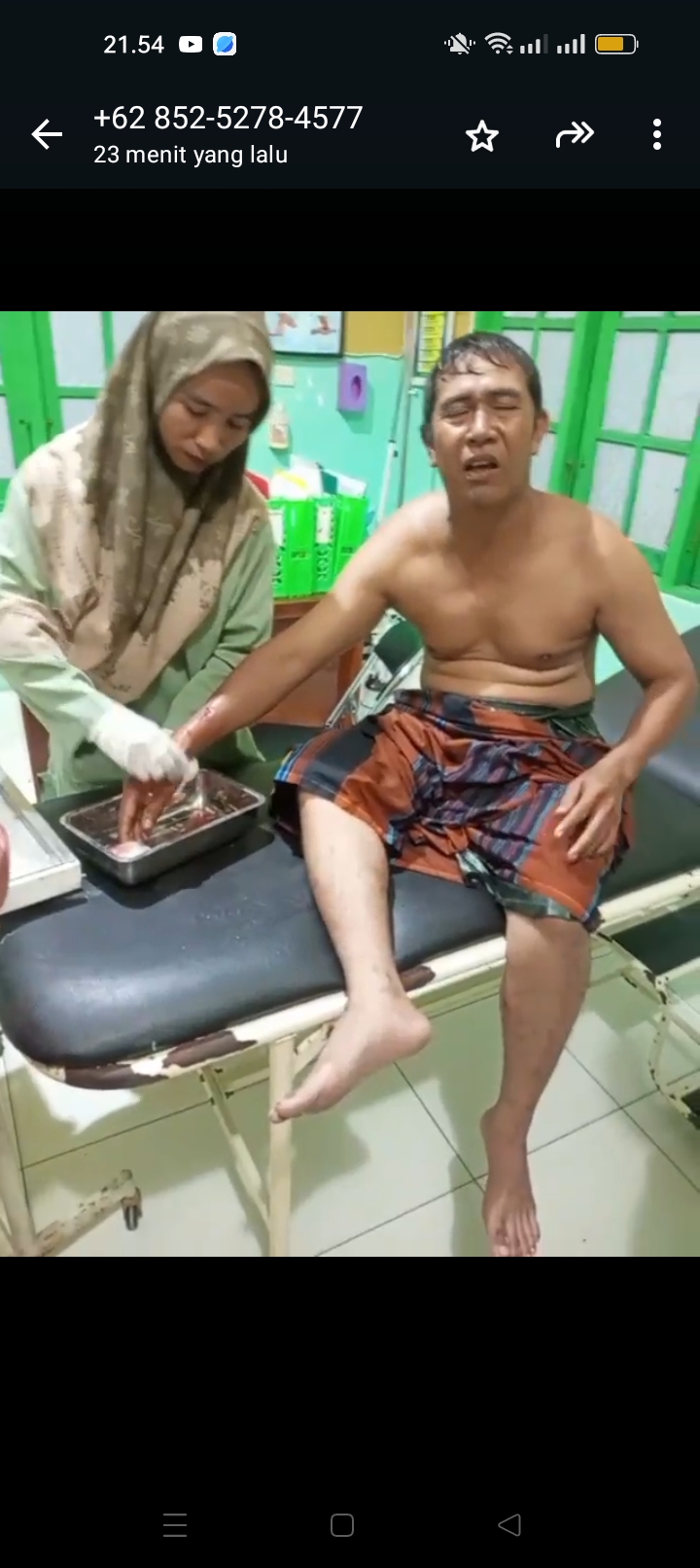 Diserang Buaya saat Berwudhu di Sungai, Warga Bagendang Tengah Dapat 15 Jahitan